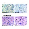 endres-wiedemann_et_al__2016_cancer_cell_derived_il_1alpha_induces_ccl22_and_the_recruitment_of_regulatory_t_cells_500.100x0.jpeg